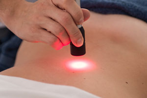 trattamenti laser terapia a Roma. adatte a curare tendinite, distorsione, contusione, artrosi, tallonite, infiammazione o flogosi, edema, ematoma, ulcere e piaghe.