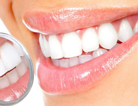 Pulizia dei denti a Roma - Promo Corona in ceramica