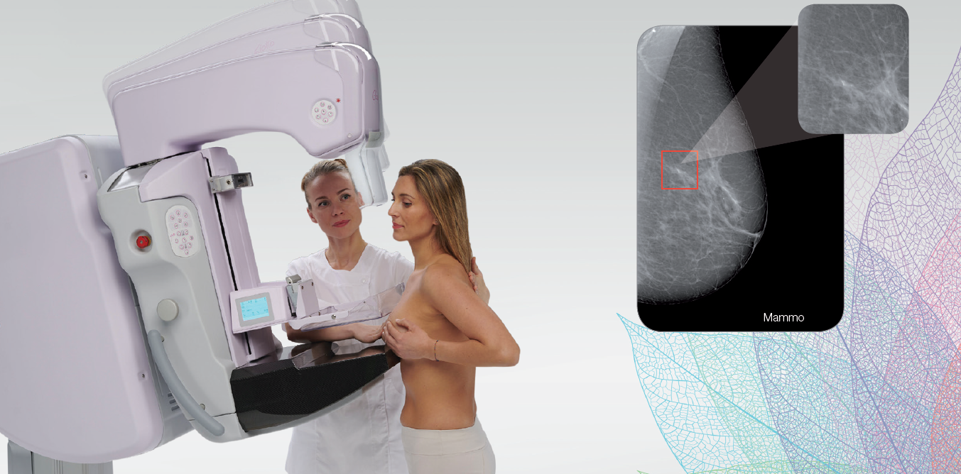 Mammografia con Tomosintesi Mammografia con Tomosintesi