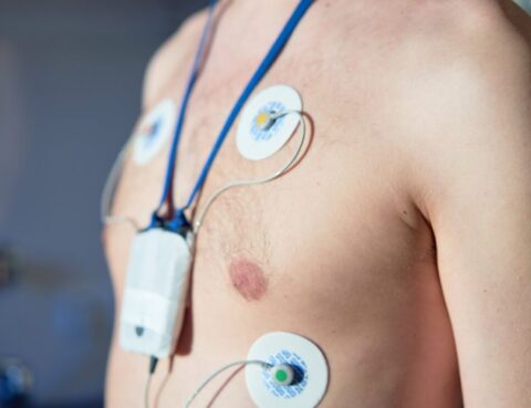 Holter cardiaco Roma | Promo 59 € | Centro Medico Arcidiacono