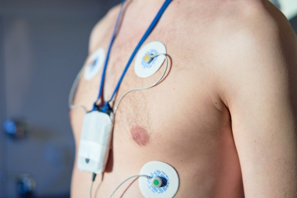 Holter cardiaco Roma | Promo 59 € | Centro Medico Arcidiacono