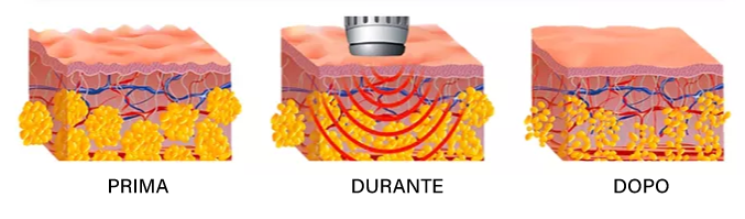 fasi onde d'urto roma